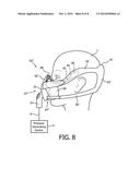 PATIENT INTERFACE DEVICE WITH NOSE BRIDGE  ADJUSTMENT diagram and image