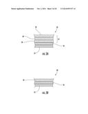 Injection-Molded Composite Construct diagram and image