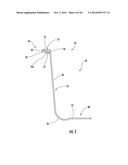 Injection-Molded Composite Construct diagram and image