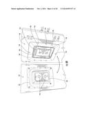 Injection-Molded Composite Construct diagram and image