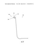 Injection-Molded Composite Construct diagram and image