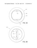 Cup-shaped Nozzle Assembly with Integral Filter Structure diagram and image