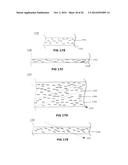 Method of Manufacturing a Body with Oriented Aspherical Particles diagram and image