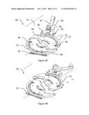 SPLITBOARD BINDING APPARATUS diagram and image