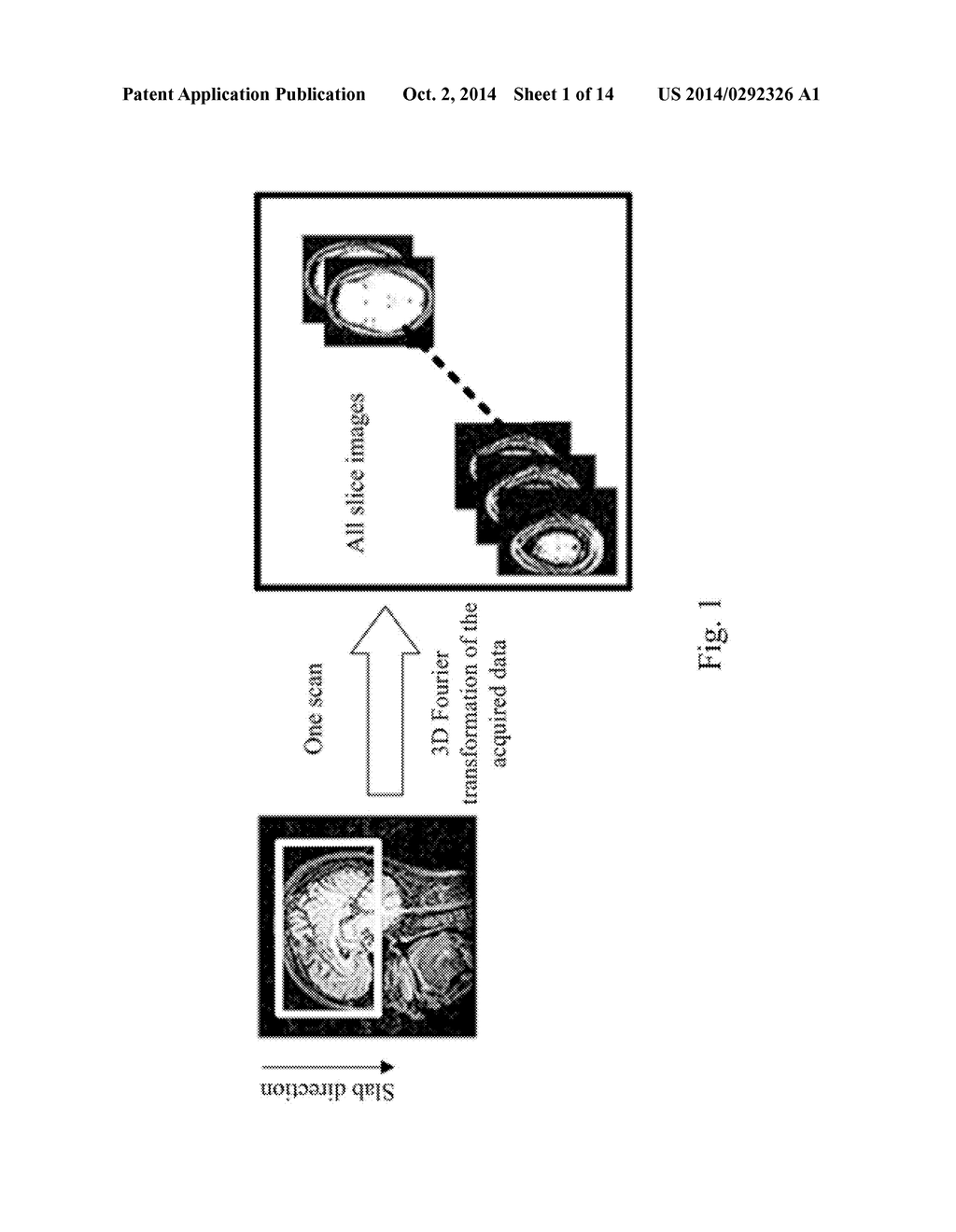 Method and Apparatus for 3D Magnetic Resonance Imaging - diagram, schematic, and image 02