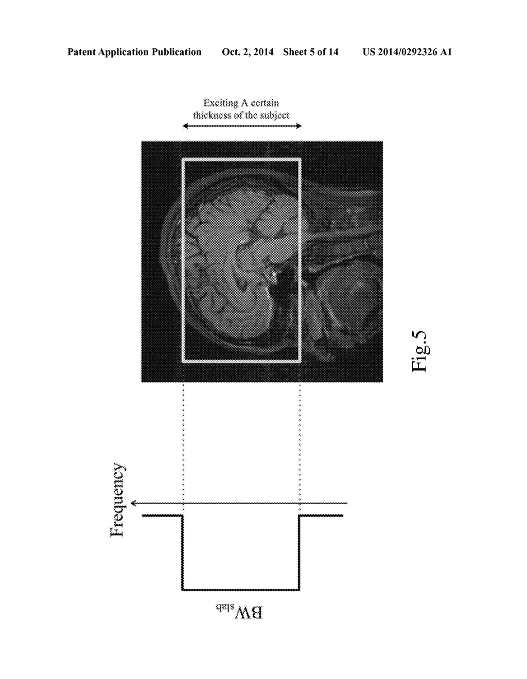 Method and Apparatus for 3D Magnetic Resonance Imaging - diagram, schematic, and image 06