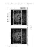 Method and Apparatus for 3D Magnetic Resonance Imaging diagram and image