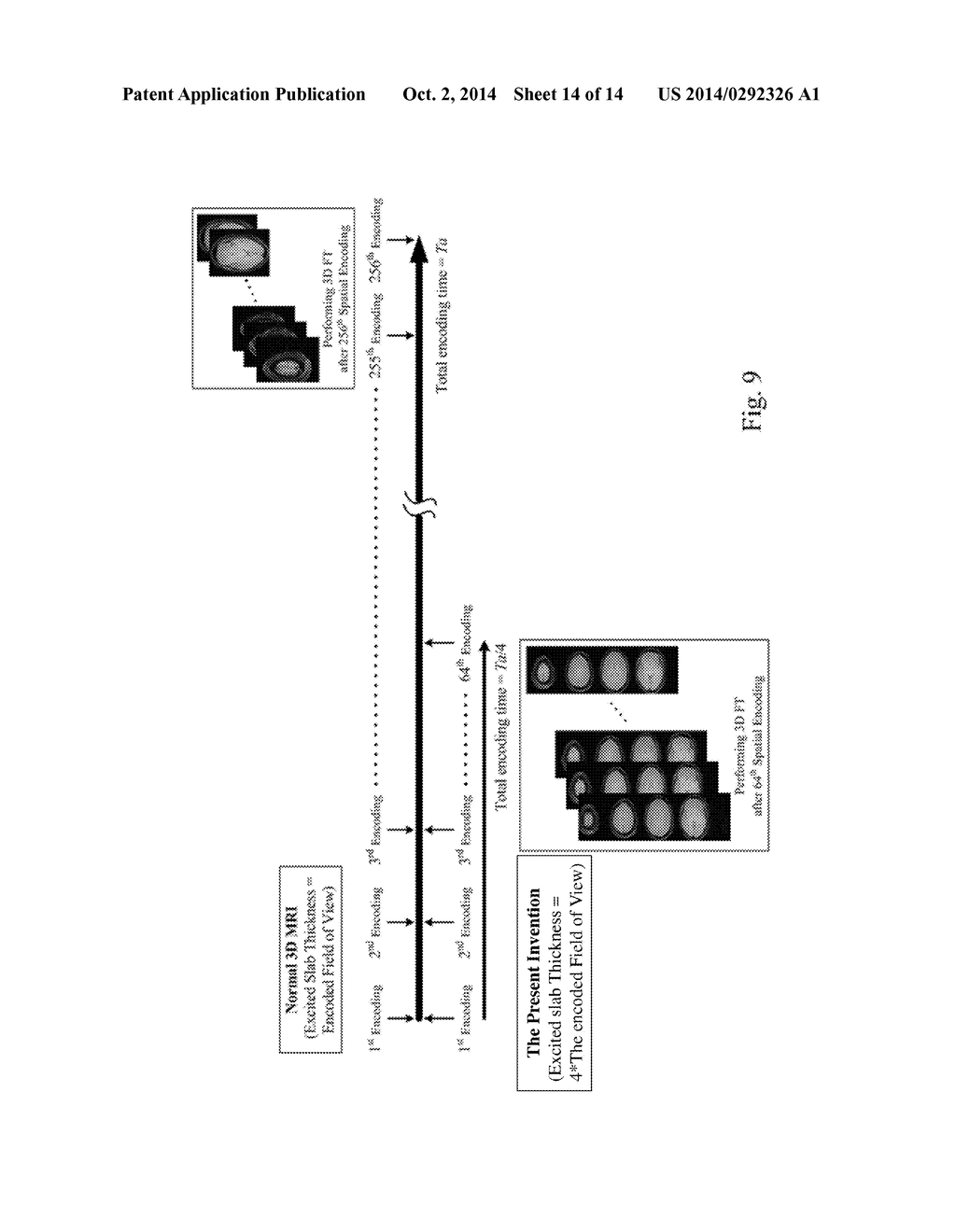 Method and Apparatus for 3D Magnetic Resonance Imaging - diagram, schematic, and image 15