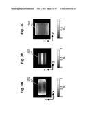 Magnetic resonance imaging equipment, high frequency magnetic field     irradiation method and program diagram and image