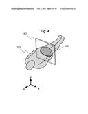 Magnetic resonance imaging equipment, high frequency magnetic field     irradiation method and program diagram and image