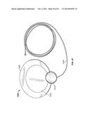 ANTENNA ASSEMBLIES WITH TAPERED LOOP ANTENNA ELEMENTS diagram and image