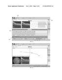 USER INTERFACE FOR ACQUISITION, DISPLAY AND ANALYSIS OF OPHTHALMIC     DIAGNOSTIC DATA diagram and image