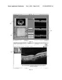 USER INTERFACE FOR ACQUISITION, DISPLAY AND ANALYSIS OF OPHTHALMIC     DIAGNOSTIC DATA diagram and image