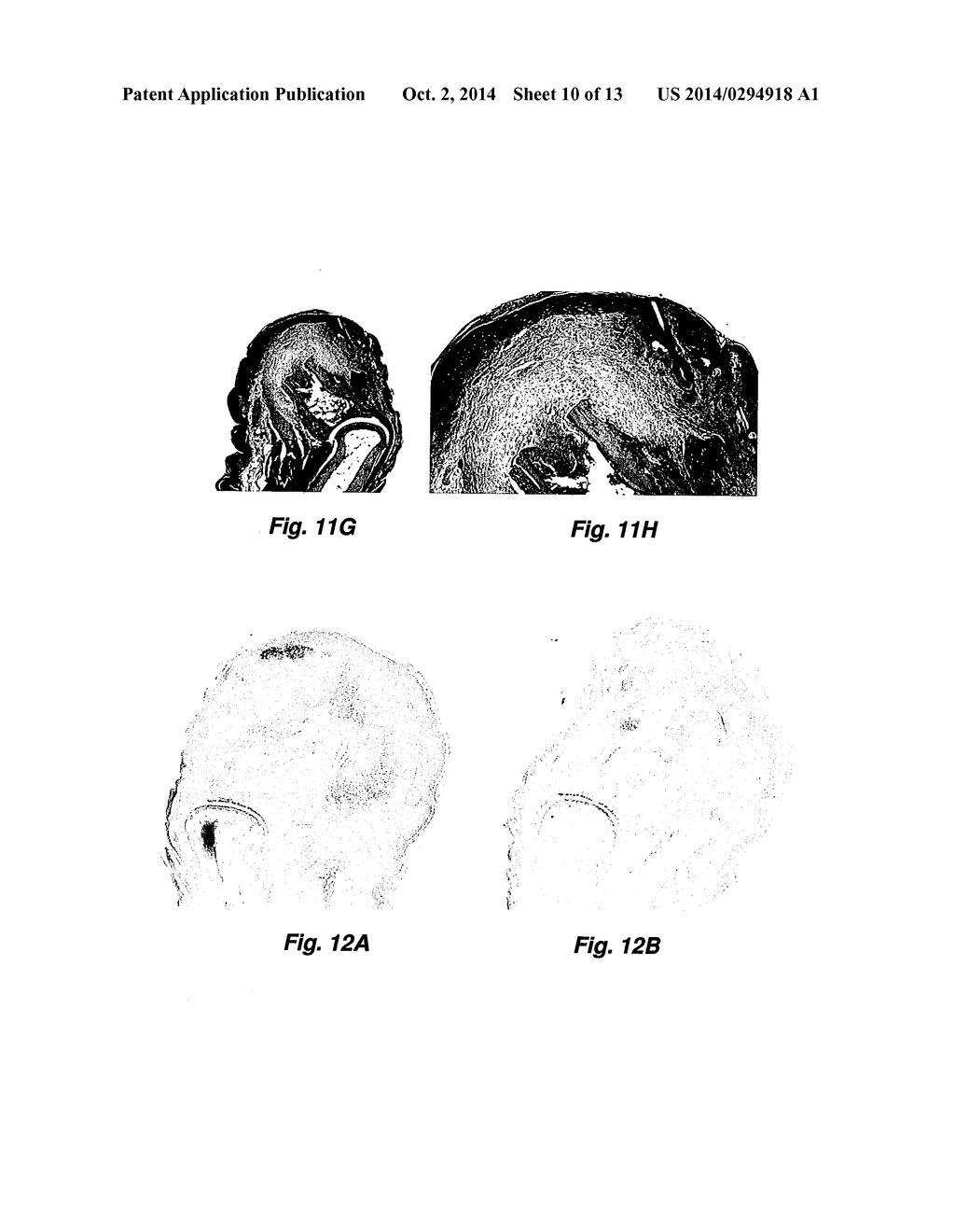 Matricryptic ECM Peptides for Tissue Reconstruction - diagram, schematic, and image 11