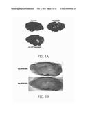 TREATMENT FOR EXPOSURE TO NERVE AGENT diagram and image