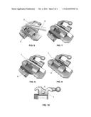 Orthodontic Accessory diagram and image