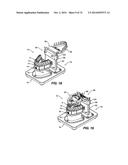 IMPRESSIONLESS DENTAL MODELING SYSTEMS AND METHODS diagram and image