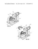 IMPRESSIONLESS DENTAL MODELING SYSTEMS AND METHODS diagram and image