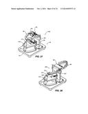 IMPRESSIONLESS DENTAL MODELING SYSTEMS AND METHODS diagram and image