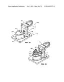 IMPRESSIONLESS DENTAL MODELING SYSTEMS AND METHODS diagram and image