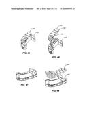 IMPRESSIONLESS DENTAL MODELING SYSTEMS AND METHODS diagram and image