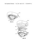 IMPRESSIONLESS DENTAL MODELING SYSTEMS AND METHODS diagram and image