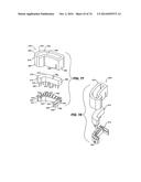 IMPRESSIONLESS DENTAL MODELING SYSTEMS AND METHODS diagram and image