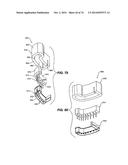 IMPRESSIONLESS DENTAL MODELING SYSTEMS AND METHODS diagram and image