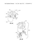 IMPRESSIONLESS DENTAL MODELING SYSTEMS AND METHODS diagram and image