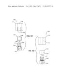 IMPRESSIONLESS DENTAL MODELING SYSTEMS AND METHODS diagram and image