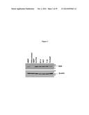 ELISA Detection of Urine DEK to Predict and Diagnose Bladder Cancer in     Humans diagram and image