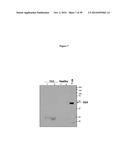 ELISA Detection of Urine DEK to Predict and Diagnose Bladder Cancer in     Humans diagram and image