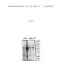 ELISA Detection of Urine DEK to Predict and Diagnose Bladder Cancer in     Humans diagram and image