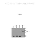 ELISA Detection of Urine DEK to Predict and Diagnose Bladder Cancer in     Humans diagram and image