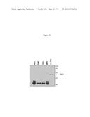 ELISA Detection of Urine DEK to Predict and Diagnose Bladder Cancer in     Humans diagram and image