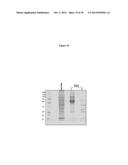 ELISA Detection of Urine DEK to Predict and Diagnose Bladder Cancer in     Humans diagram and image