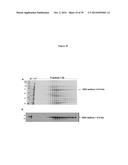 ELISA Detection of Urine DEK to Predict and Diagnose Bladder Cancer in     Humans diagram and image