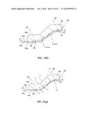 GOLF CLUB HEAD WITH A BODY-CONFORMING WEIGHT MEMBER diagram and image