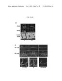 THERAPEUTIC METHODS AND COMPOSITIONS INVOLVING ALLOSTERIC KINASE     INHIBITION diagram and image