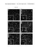 THERAPEUTIC METHODS AND COMPOSITIONS INVOLVING ALLOSTERIC KINASE     INHIBITION diagram and image