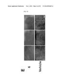 THERAPEUTIC METHODS AND COMPOSITIONS INVOLVING ALLOSTERIC KINASE     INHIBITION diagram and image