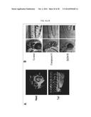 THERAPEUTIC METHODS AND COMPOSITIONS INVOLVING ALLOSTERIC KINASE     INHIBITION diagram and image