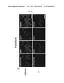 THERAPEUTIC METHODS AND COMPOSITIONS INVOLVING ALLOSTERIC KINASE     INHIBITION diagram and image