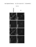 THERAPEUTIC METHODS AND COMPOSITIONS INVOLVING ALLOSTERIC KINASE     INHIBITION diagram and image
