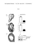 THERAPEUTIC METHODS AND COMPOSITIONS INVOLVING ALLOSTERIC KINASE     INHIBITION diagram and image