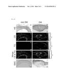 PROPHYLACTIC AND/OR THERAPEUTIC AGENT FOR CARDIOVASCULAR COMPLICATIONS OF     DIABETES diagram and image