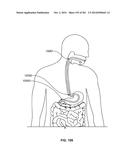 Image Capture Assembly for Use in a Multi-Viewing Elements Endoscope diagram and image