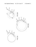 ENHANCED COMPENSATION OF MOTION IN A MOVING ORGAN USING PROCESSED     REFERENCE SENSOR DATA diagram and image