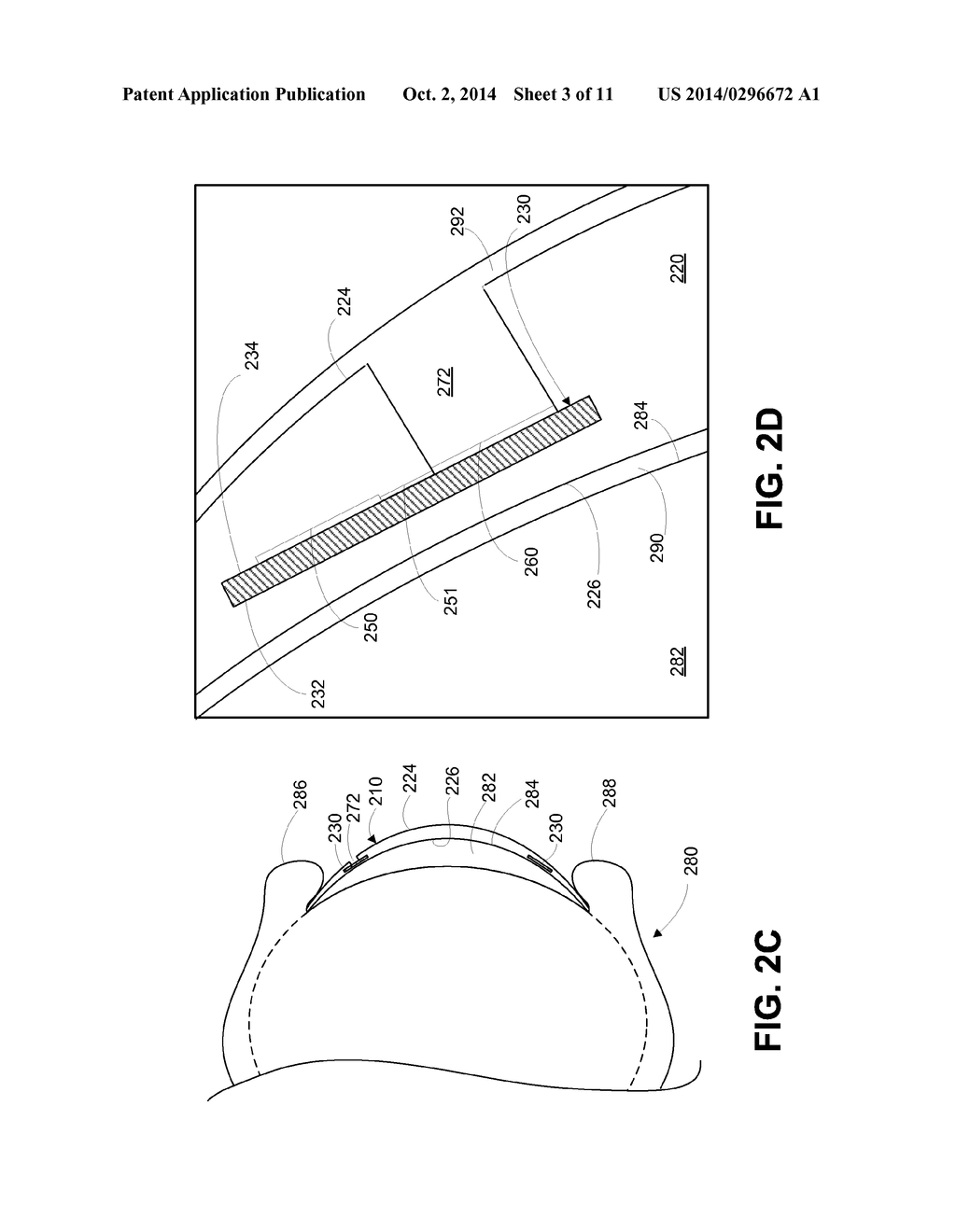 Systems and Methods for Encapsulating Electronics in a Mountable Device - diagram, schematic, and image 04