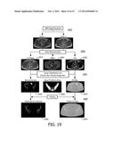 METHOD AND SYSTEM USING MAGNETIC RESONANCE IMAGING FOR TISSUE     CLASSIFICATION AND BULK-DENSITY ASSIGNMENT diagram and image